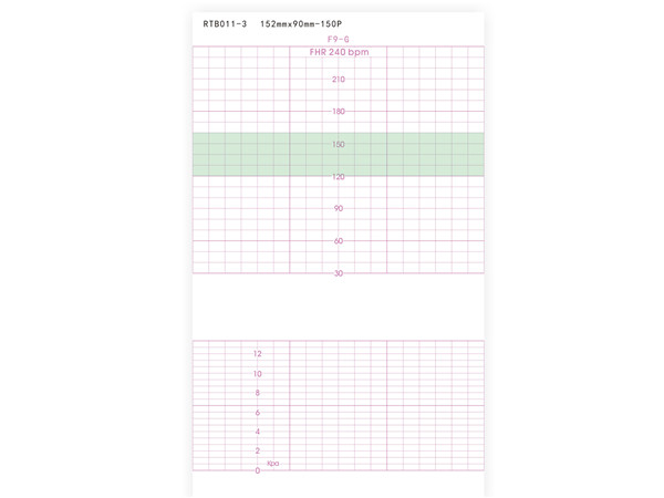 152mmx90mm-150P 胎儿监护