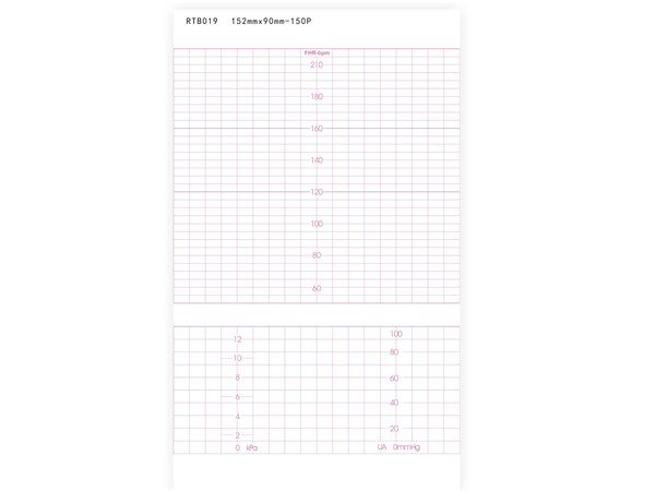 152mmx90mm-150P胎儿监护仪