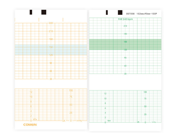 152mmx90mm-150P胎儿监护仪